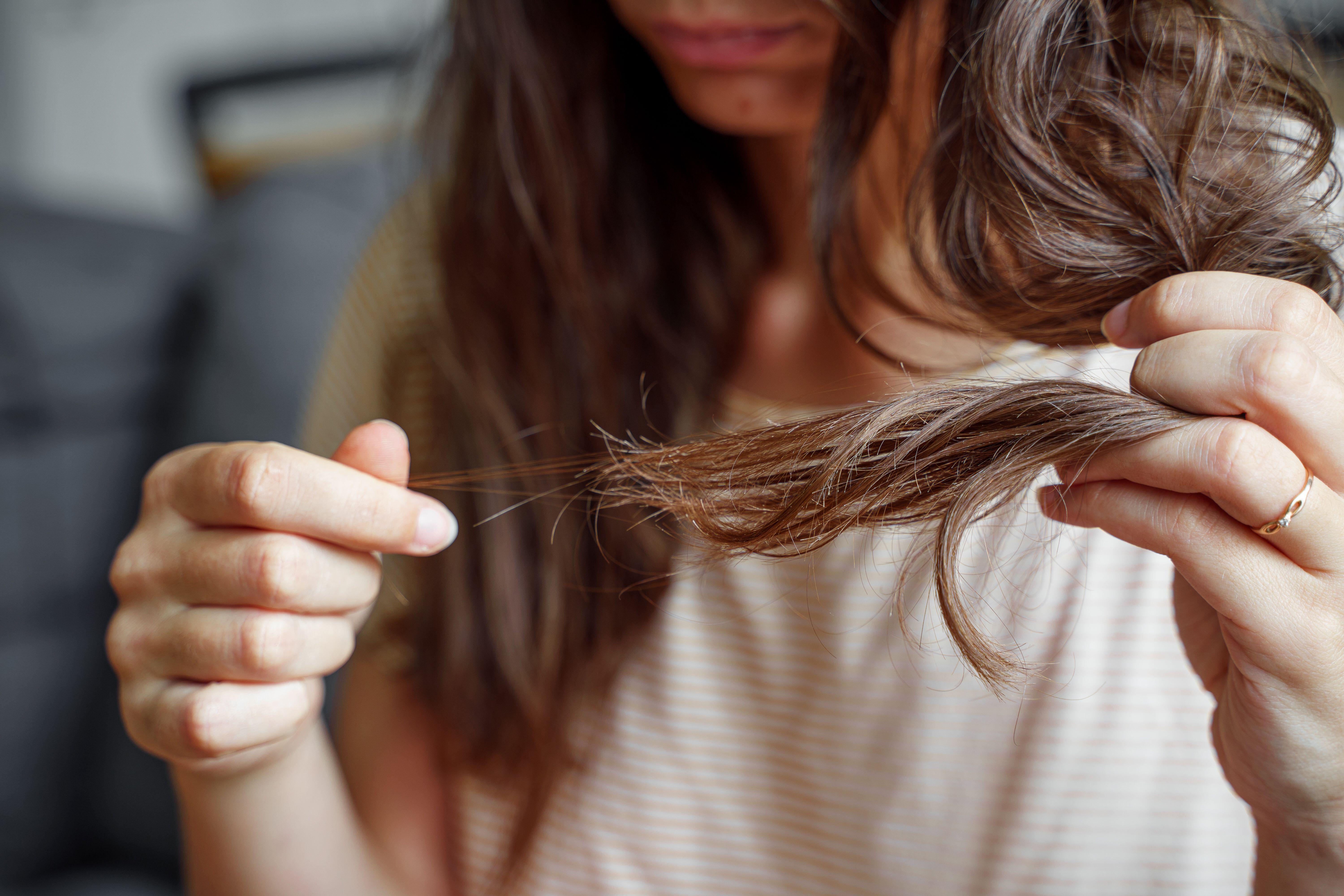 La caída del cabello puede presentarse 12 semanas después del factor desencadenante (Alamy/PA)