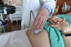 Tasa de mortalidad materna en EEUU aumentó ligeramente el año pasado