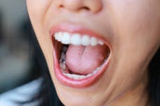 Científicos realizan un mapeo 3D de la lengua. ¿Podría facilitar la pérdida de peso?