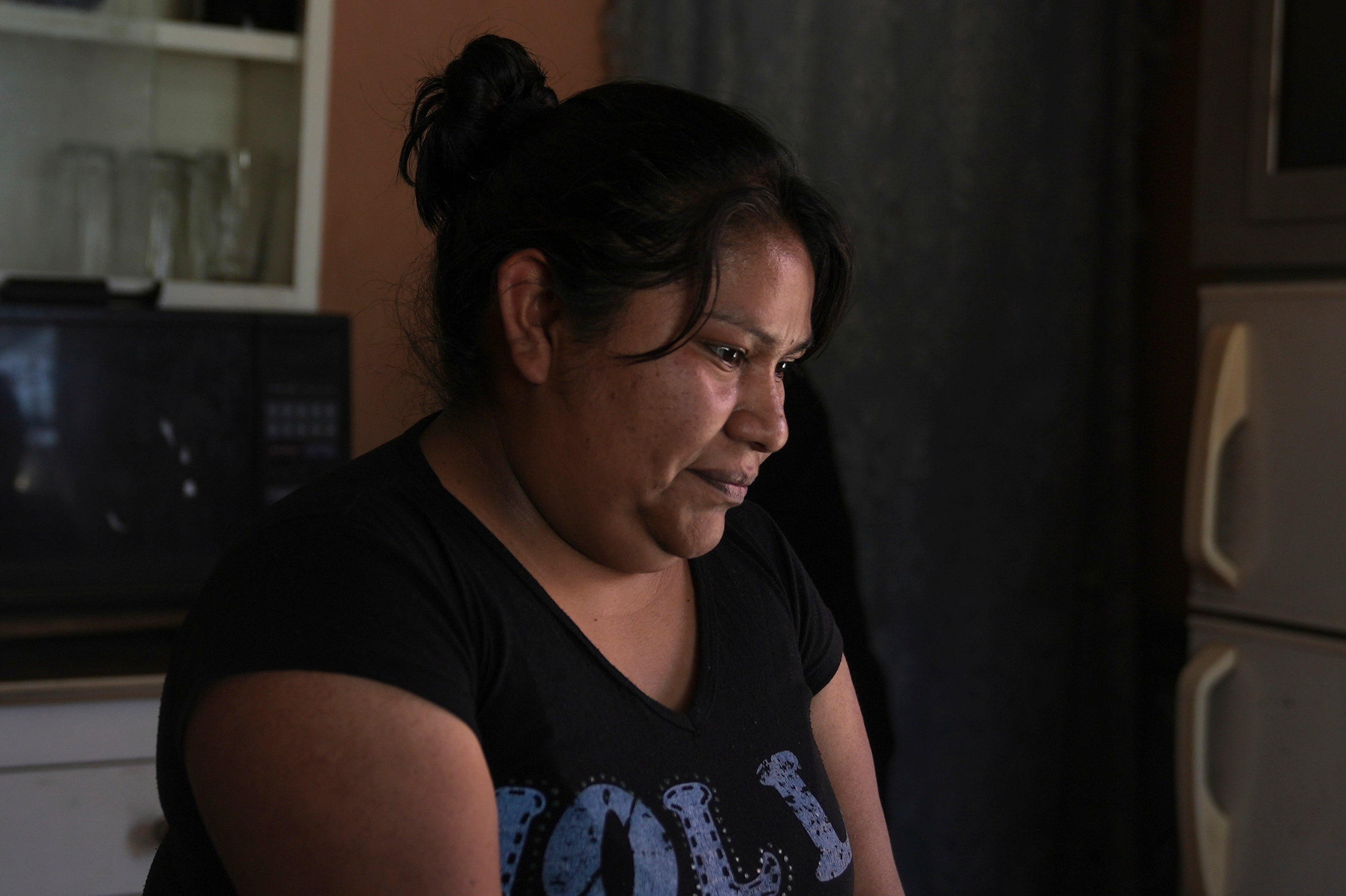 REP-GEN MÉXICO-SARAMPIÓN BROTE