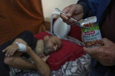 Bloqueo de Israel impide que hospitales en Gaza alimenten a sus pacientes en recuperación