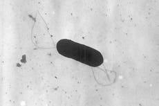 ¿Qué saber sobre los casos de listeria reportados en EEUU?
