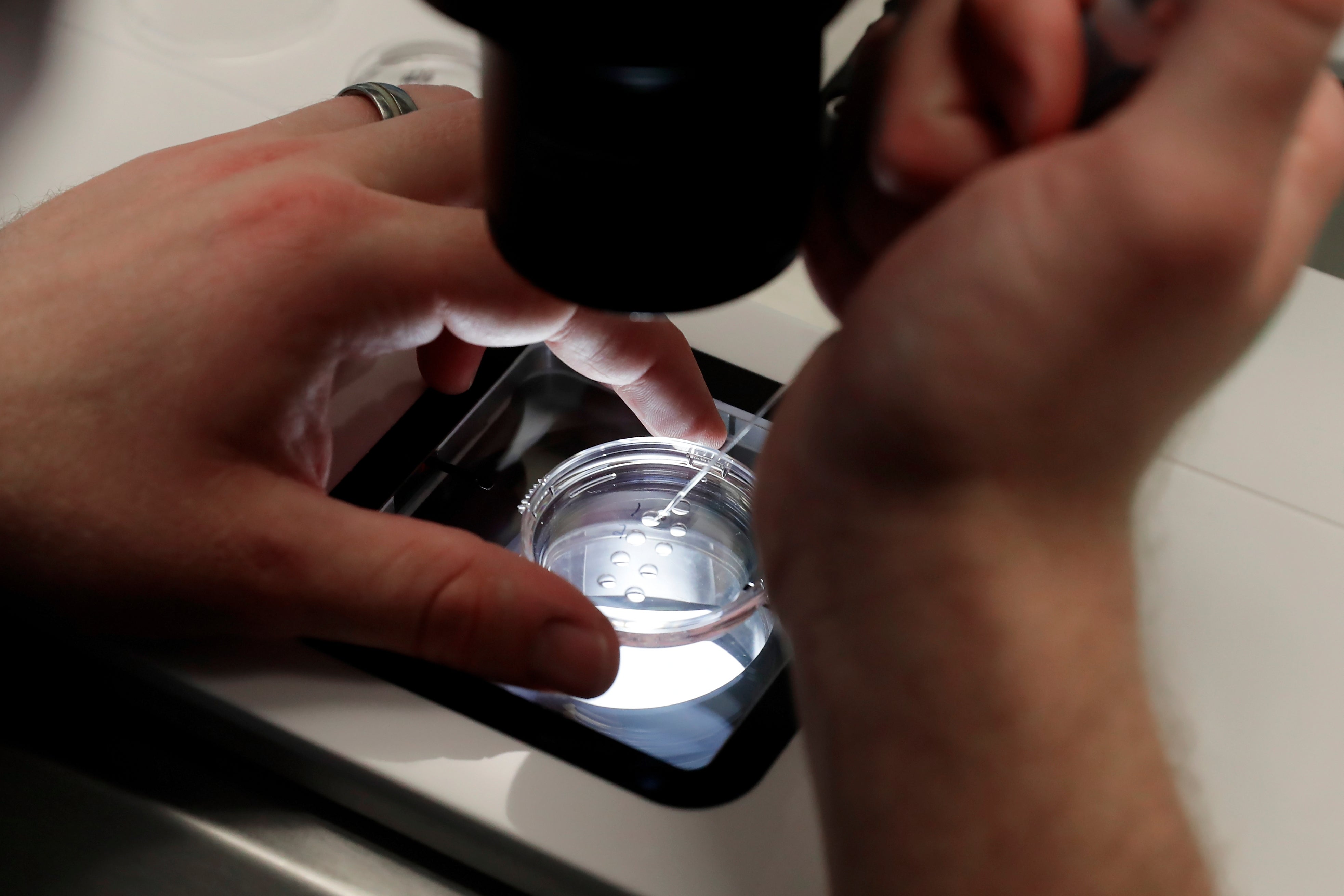TRUMP FERTILIZACION IN VITRO