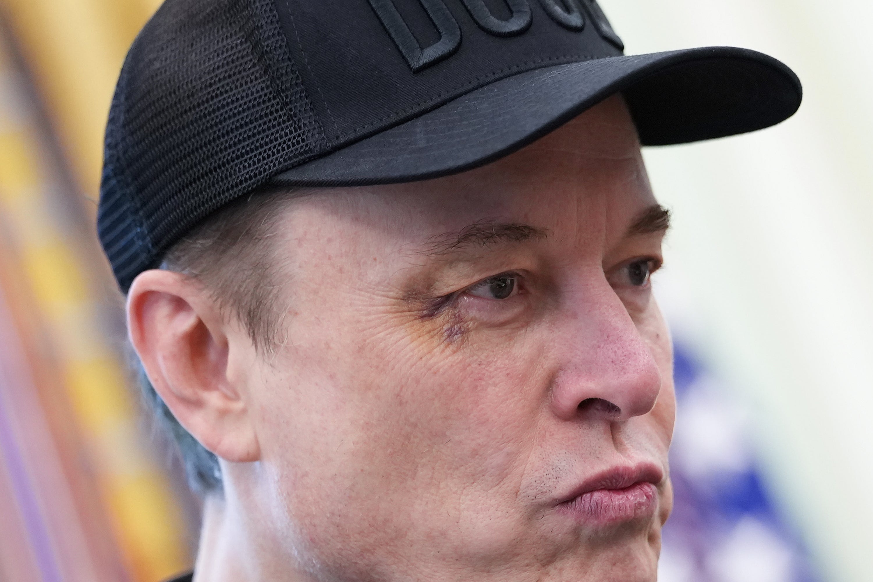 El multimillonario se presentó en la Casa Blanca con el ojo morado en el derecho. “Le dije que me diera un puñetazo en la cara y me lo dio", dijo Musk