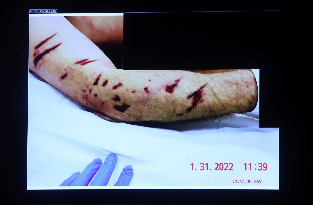 Foto de la autopsia del agente de policía de Boston fallecido John O'Keefe que se exhibió durante el nuevo juicio