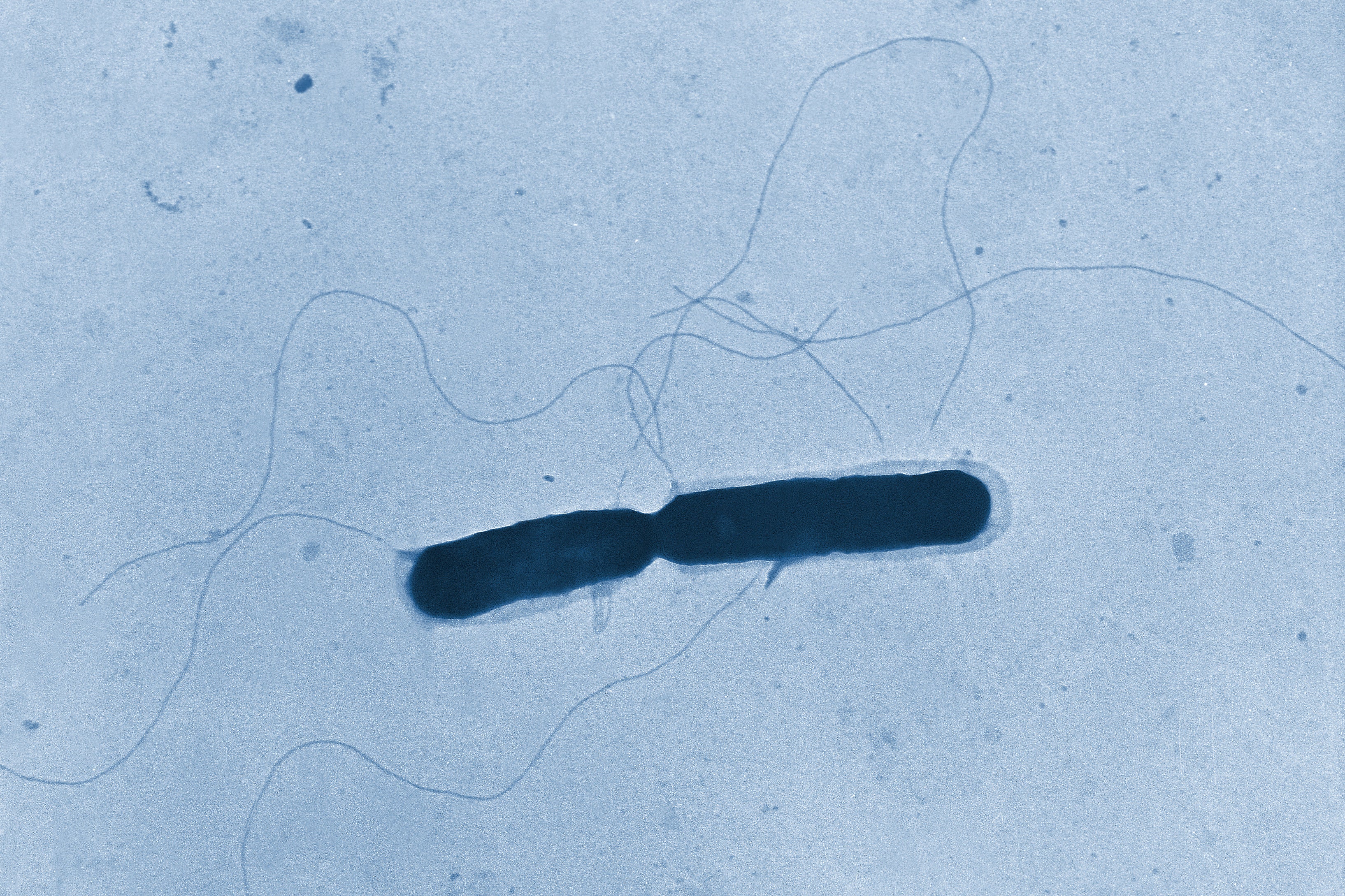 EEUU-LISTERIA-BROTE