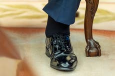 Diagnóstico de Trump: ¿qué es la insuficiencia venosa crónica?