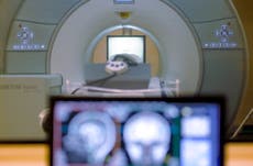 Hombre muere al ser arrastrado por una máquina de resonancia magnética en NY