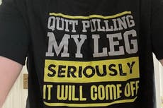 Acusan de fraude al “cirujano más valiente del Reino Unido”