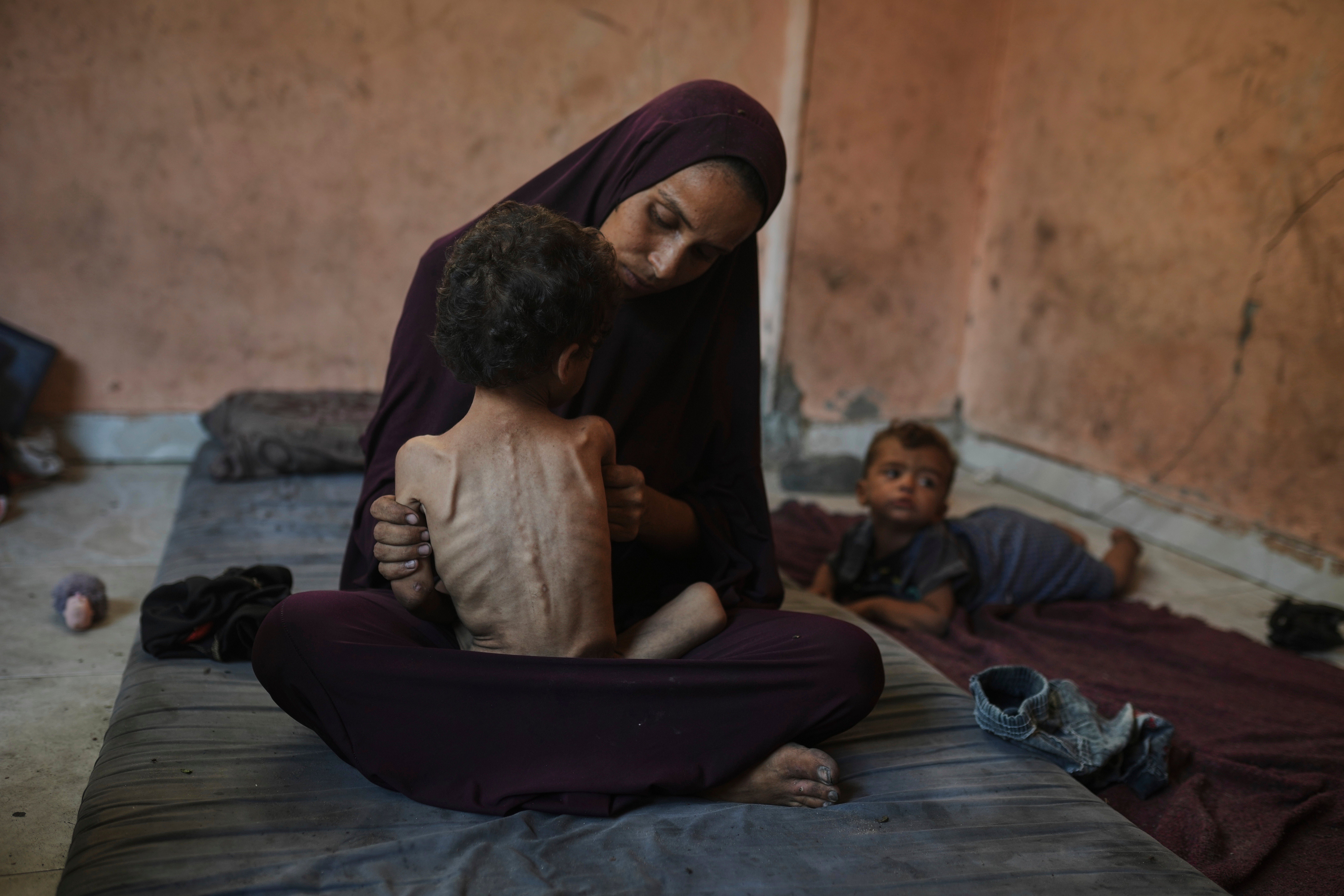 Decenas de niños en Gaza han muerto de hambre en un mes a medida que aumenta la desnutrición