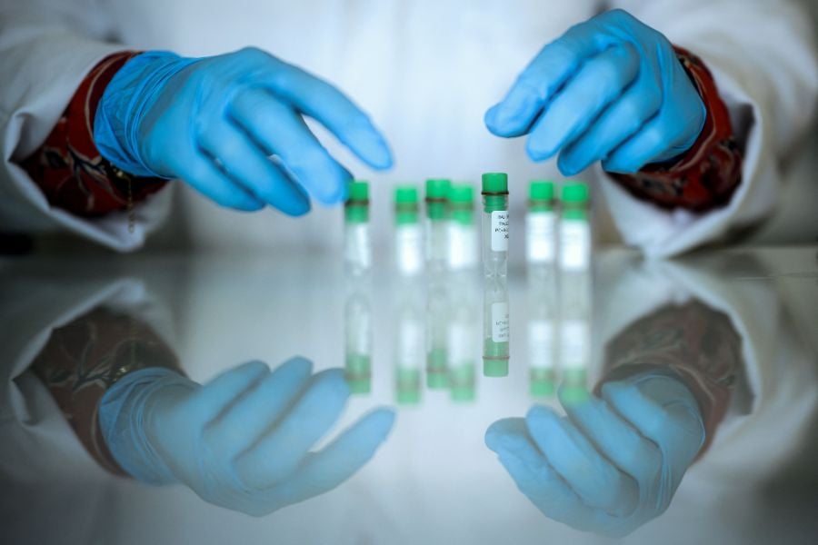 La acropaquia, a menudo un signo de cáncer de pulmón en etapa avanzada, también puede indicar otras afecciones graves, como infecciones pulmonares crónicas, cardiopatías, enfermedades gastrointestinales y trastornos autoinmunes, según el doctor Davood Johari.