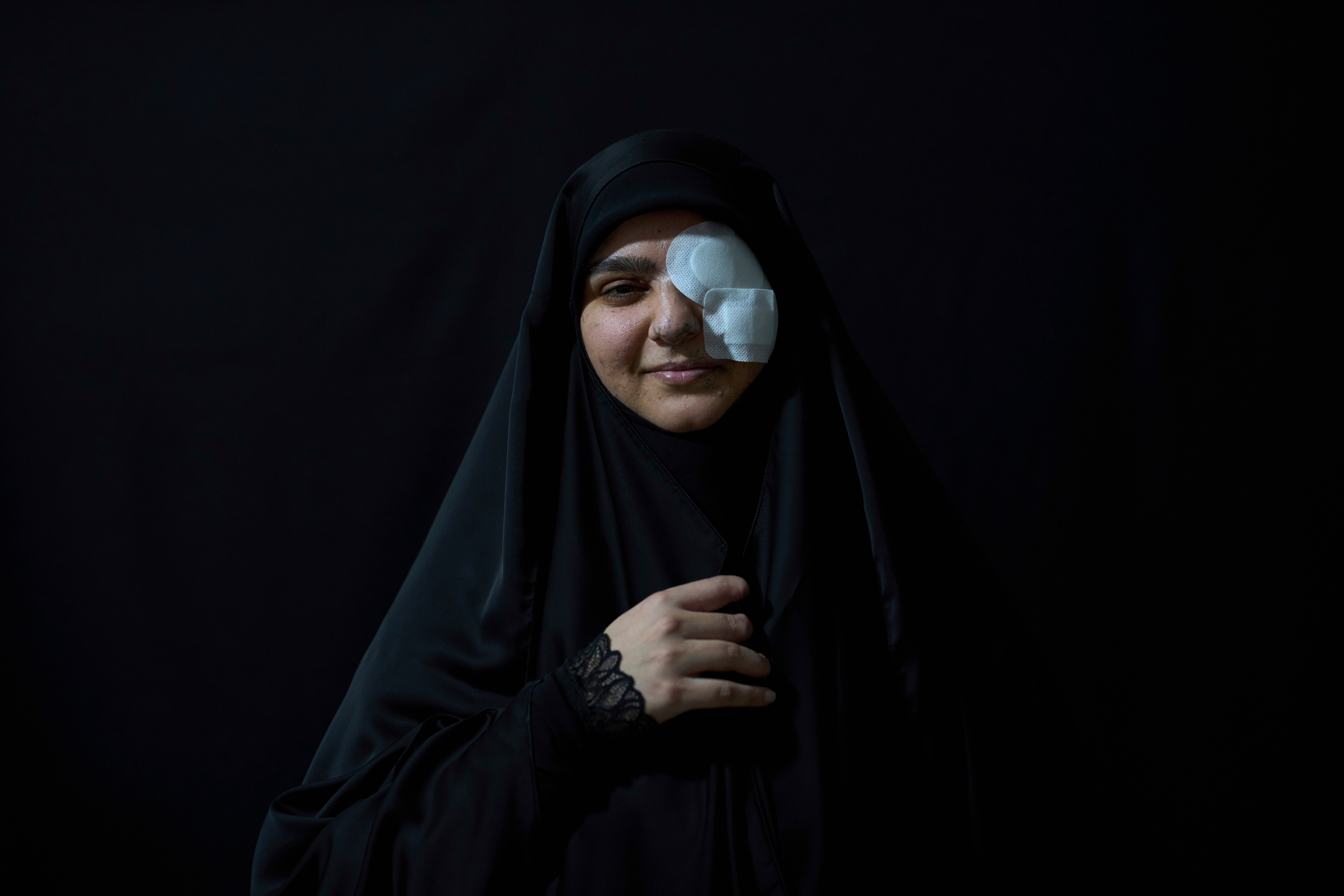 LIBANO-HEZBOLLAH-EXPLOSIONES BÍPERS-SOBREVIVIENTES