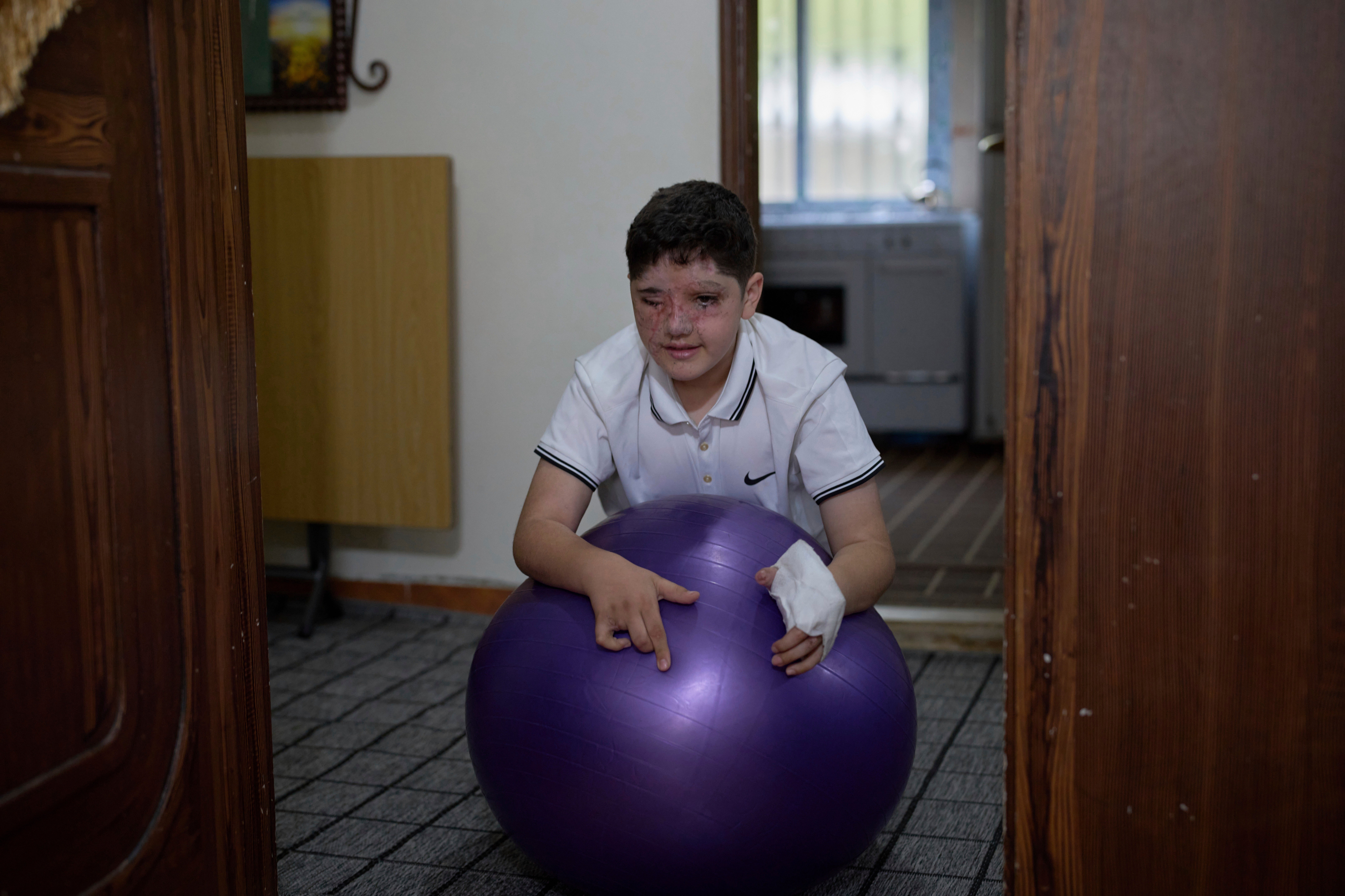 El ataque de Israel con bípers explosivos deja cicatrices profundas en Líbano