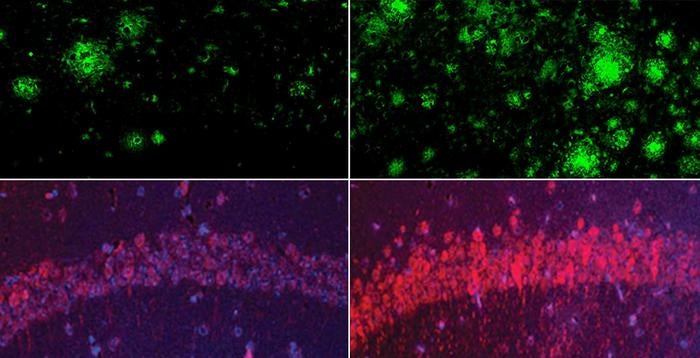 Fila superior: en un modelo de ratón de la enfermedad de Alzheimer, la deficiencia de litio (derecha) aumentó drásticamente los depósitos de beta amiloide en el cerebro en comparación con los ratones que tenían niveles fisiológicos normales de litio (izquierda). Fila inferior: lo mismo ocurrió con la proteína tau de los embrollos neurofibrilares del Alzheimer.
