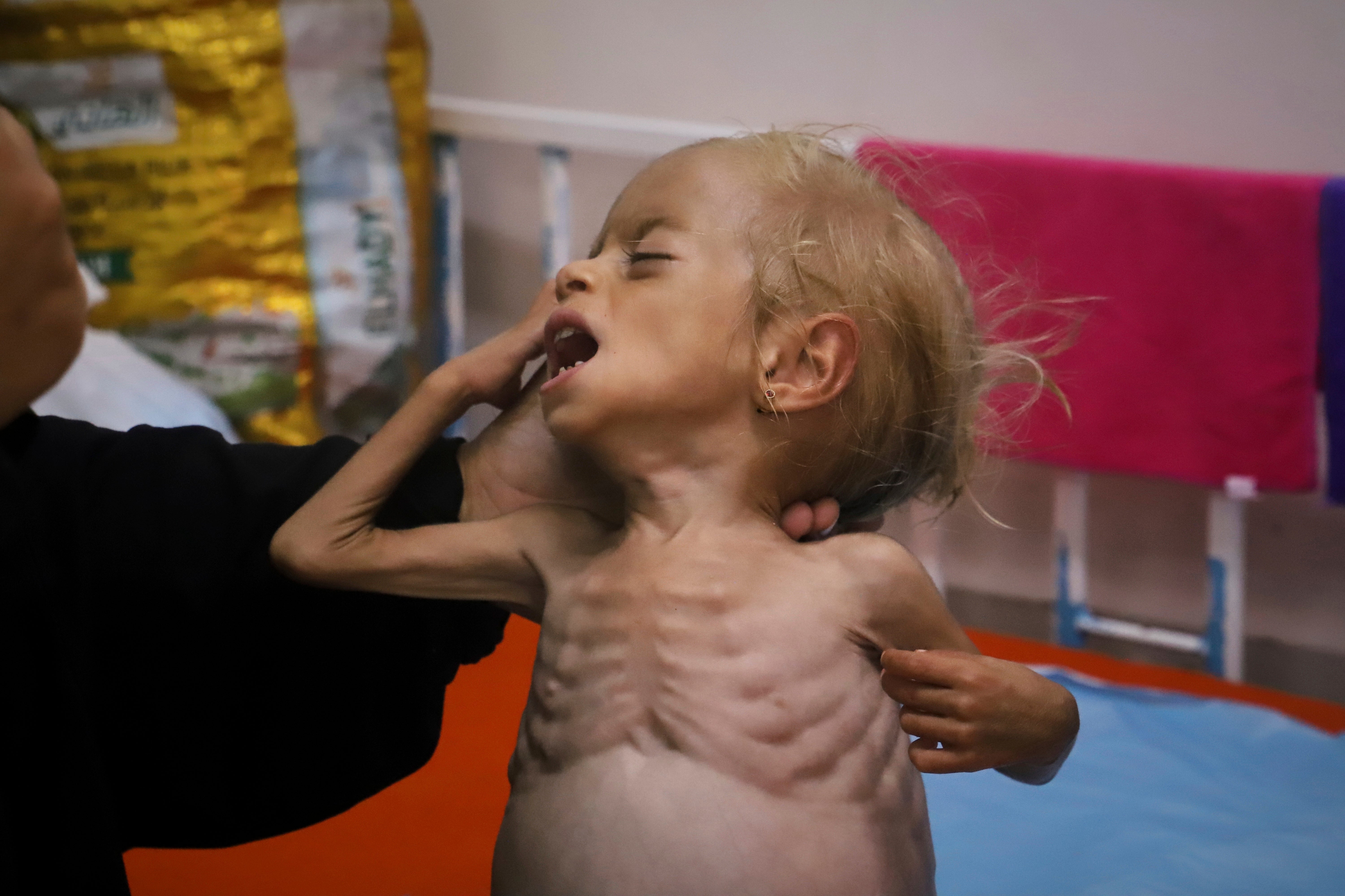 ORIENTE MEDIO-GUERRAS-GAZA-HAMBRE