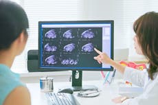 Nuevo fármaco para la endometriosis podría suponer un gran avance en el tratamiento