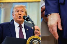 Trump culpa a los medios “falsos” por los rumores sobre su salud