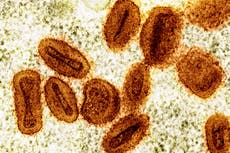 Brote de viruela símica en África ya no es una emergencia de salud global, dice OMS