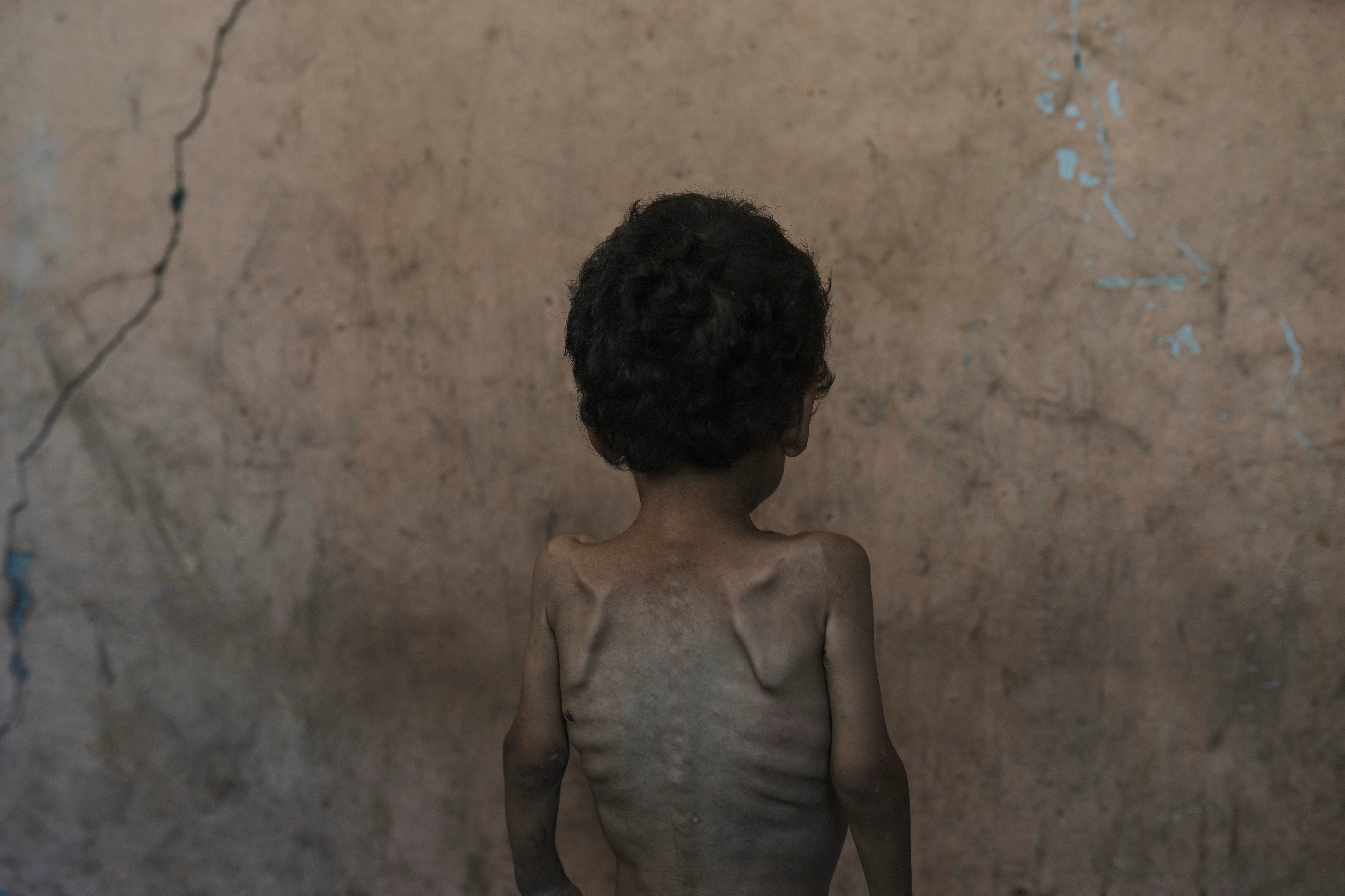GAZA-HAMBRUNA