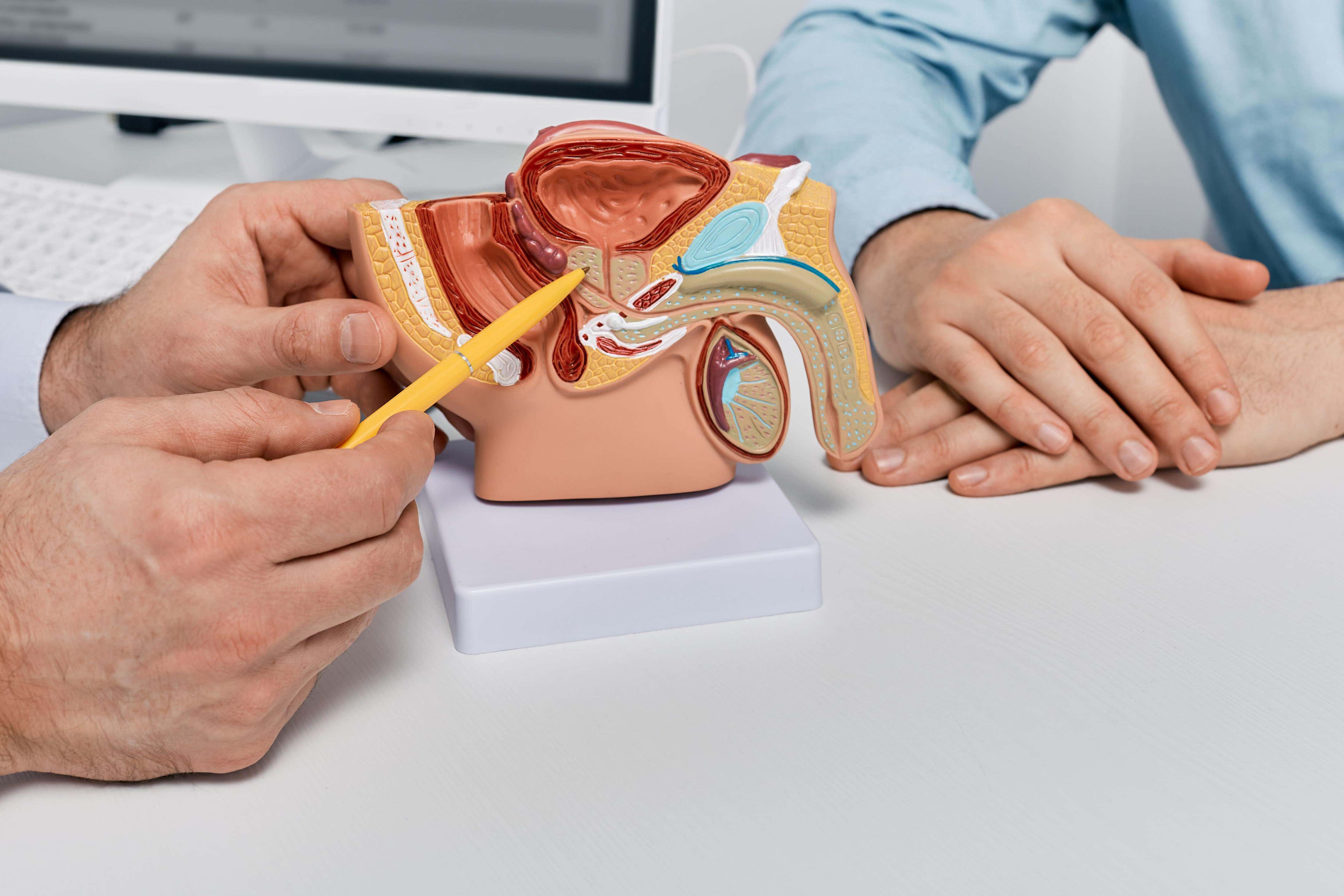 Inhibir las proteínas MCL1 y AKT al mismo tiempo desencadena la muerte celular del cáncer de próstata