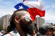 Informe revela que estallido en Chile dejó más de 20.000 víctimas, la mayoría por violencia policial