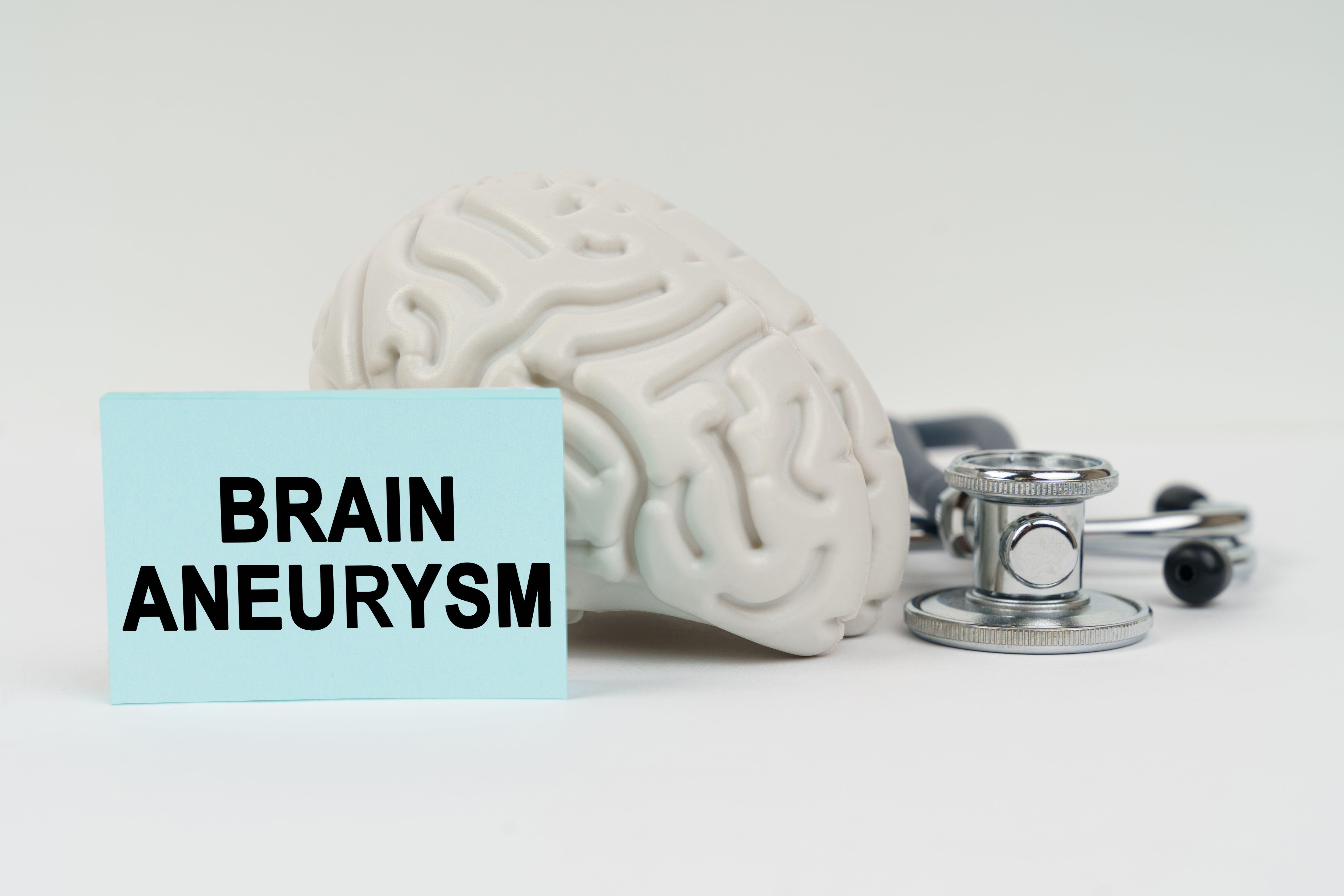 Concepto médico. En una superficie blanca junto al cerebro hay un estetoscopio y pegatinas con la inscripción: “Aneurisma cerebral”