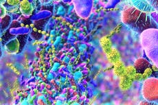 Primeros síntomas del párkinson se manifiestan en el intestino, revela estudio