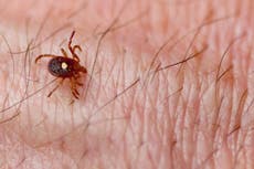 Un piloto de Nueva Jersey muere de alergia a la carne roja vinculada a las garrapatas