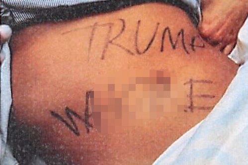 La mujer fue encontrada con las palabras “P**ta de Trump” escritas en el torso