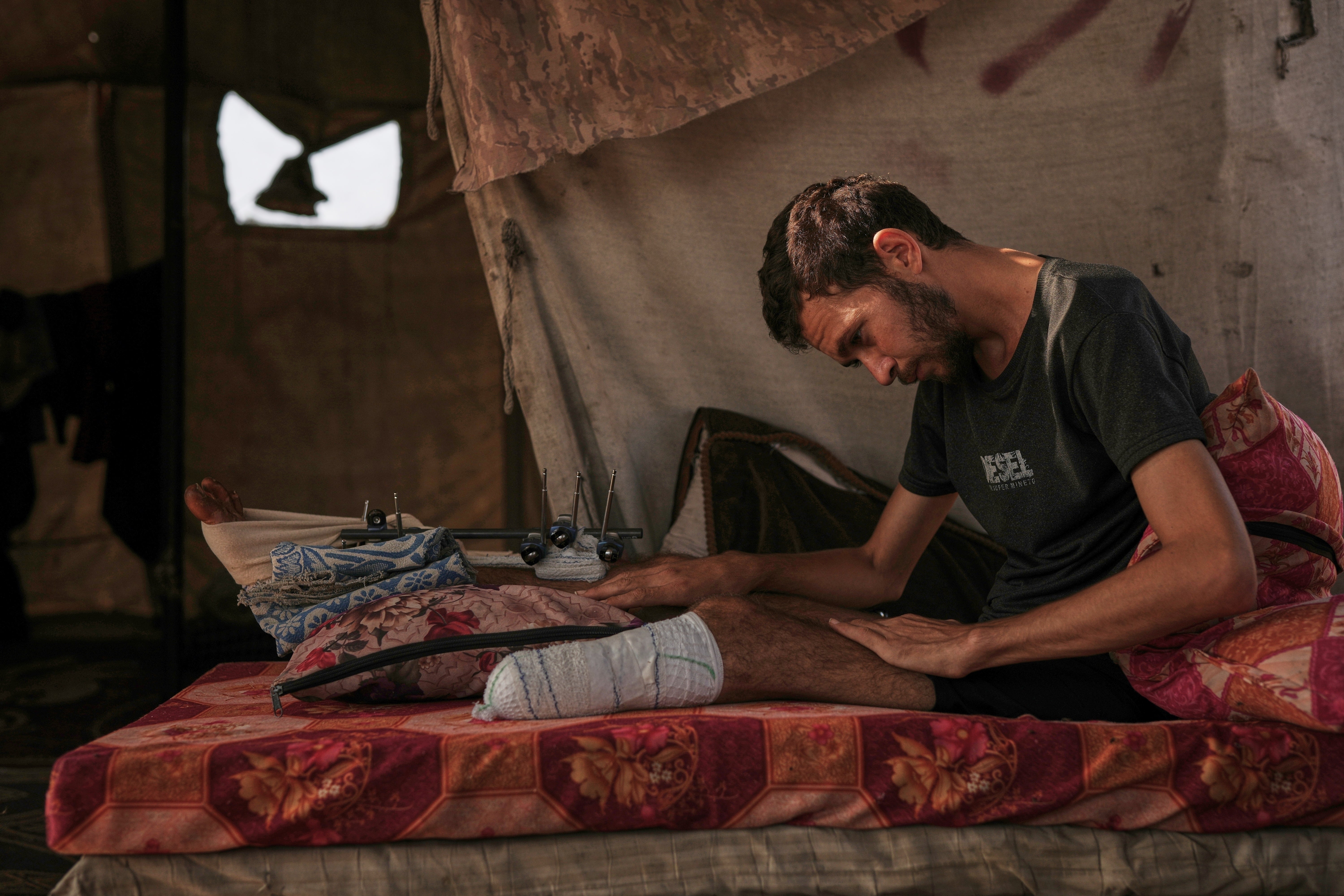 ORIENTE MEDIO-GAZA-AMPUTADOS