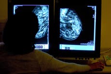 Sobrepeso en mujeres jóvenes podría disminuir el riesgo de cáncer de mama