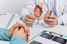 Cómo cuidar tus riñones, tras conocerse los riesgos del ibuprofeno