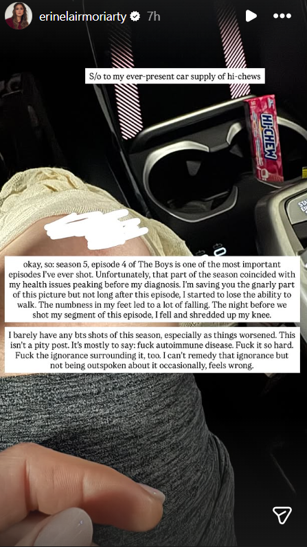 Erin Moriarty cuenta que se lesionó varias veces durante el rodaje de ‘The Boys’