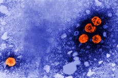 Un fármaco experimental contra la hepatitis B podría ofrecer "cura funcional" a algunos pacientes