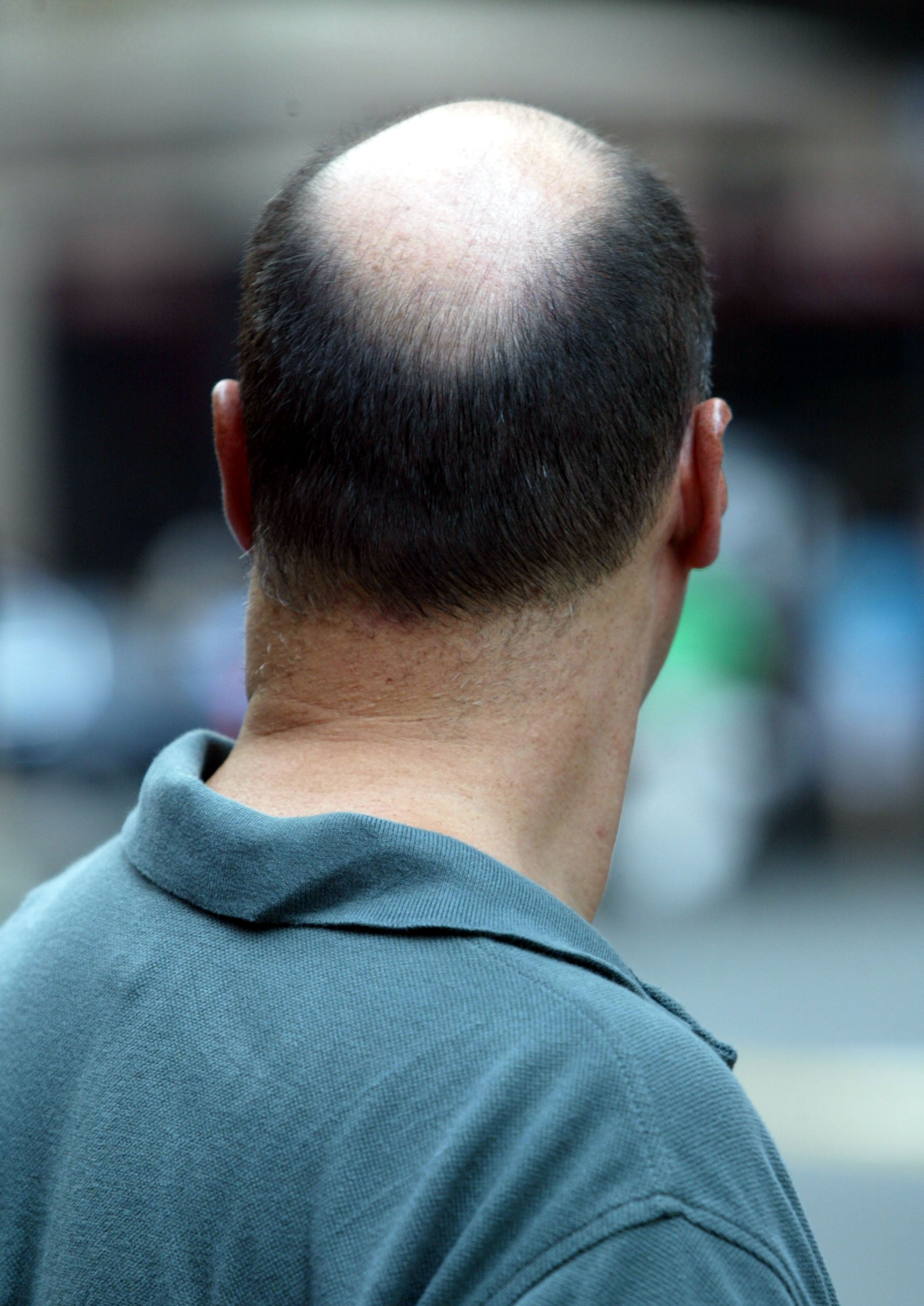 El antiguo remedio herbal chino que podría ser efectivo contra la caída del cabello