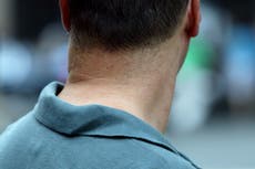 El antiguo remedio herbal chino que podría ser efectivo contra la caída del cabello