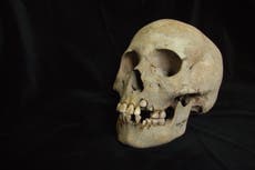 Científicos hallan la evidencia más antigua de la peste, de hace 5.500 años