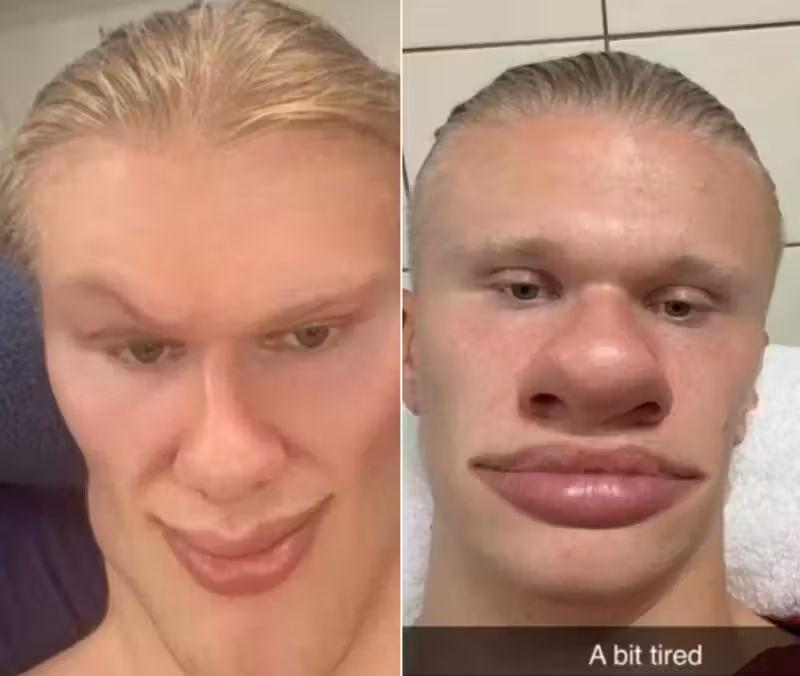 Haaland juega con los filtros faciales de Snapchat