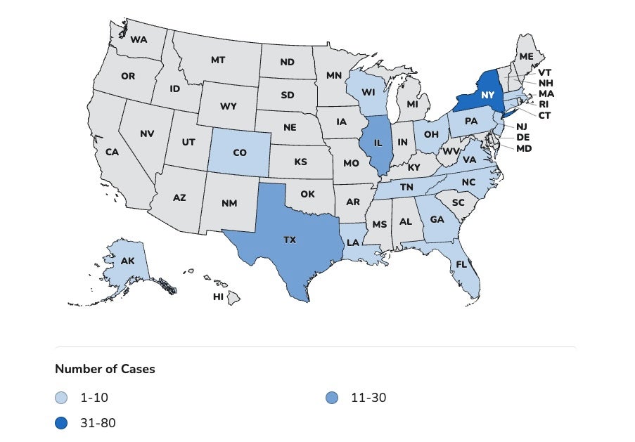 Los CDC informaron que este verano se han registrado 145 casos en Estados Unidos de un parásito que provoca diarrea acuosa