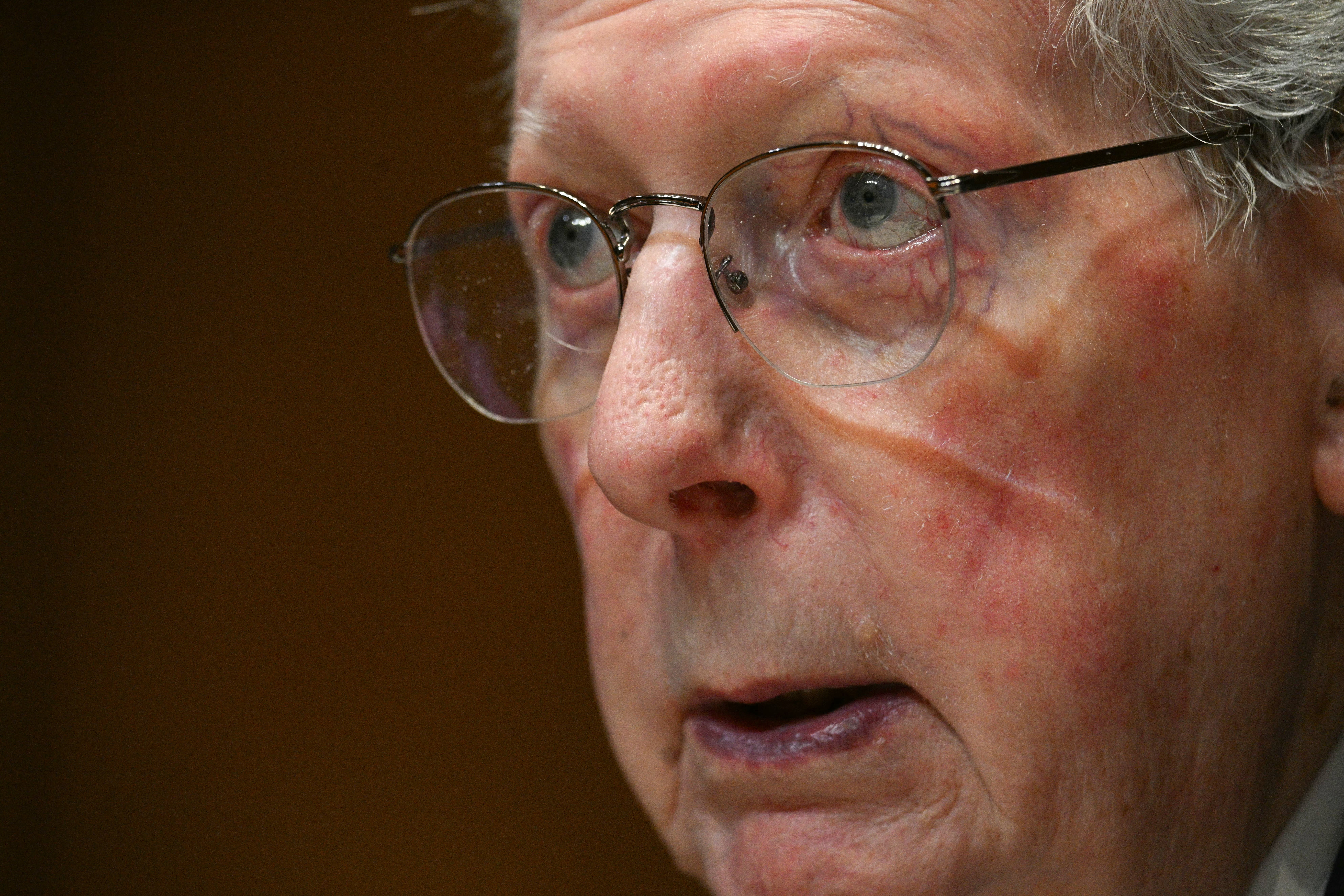 El senador Mitch McConnell podría estar cerca de regresar al trabajo, según Scott Jennings. De acuerdo con reportes, McConnell fue hospitalizado a mediados de junio