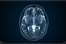 Científicos descubren que el cerebro humano consta de dos órganos separados
