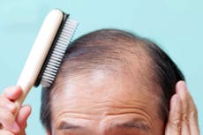Un nuevo estudio relaciona los fármacos para bajar de peso con la caída del cabello