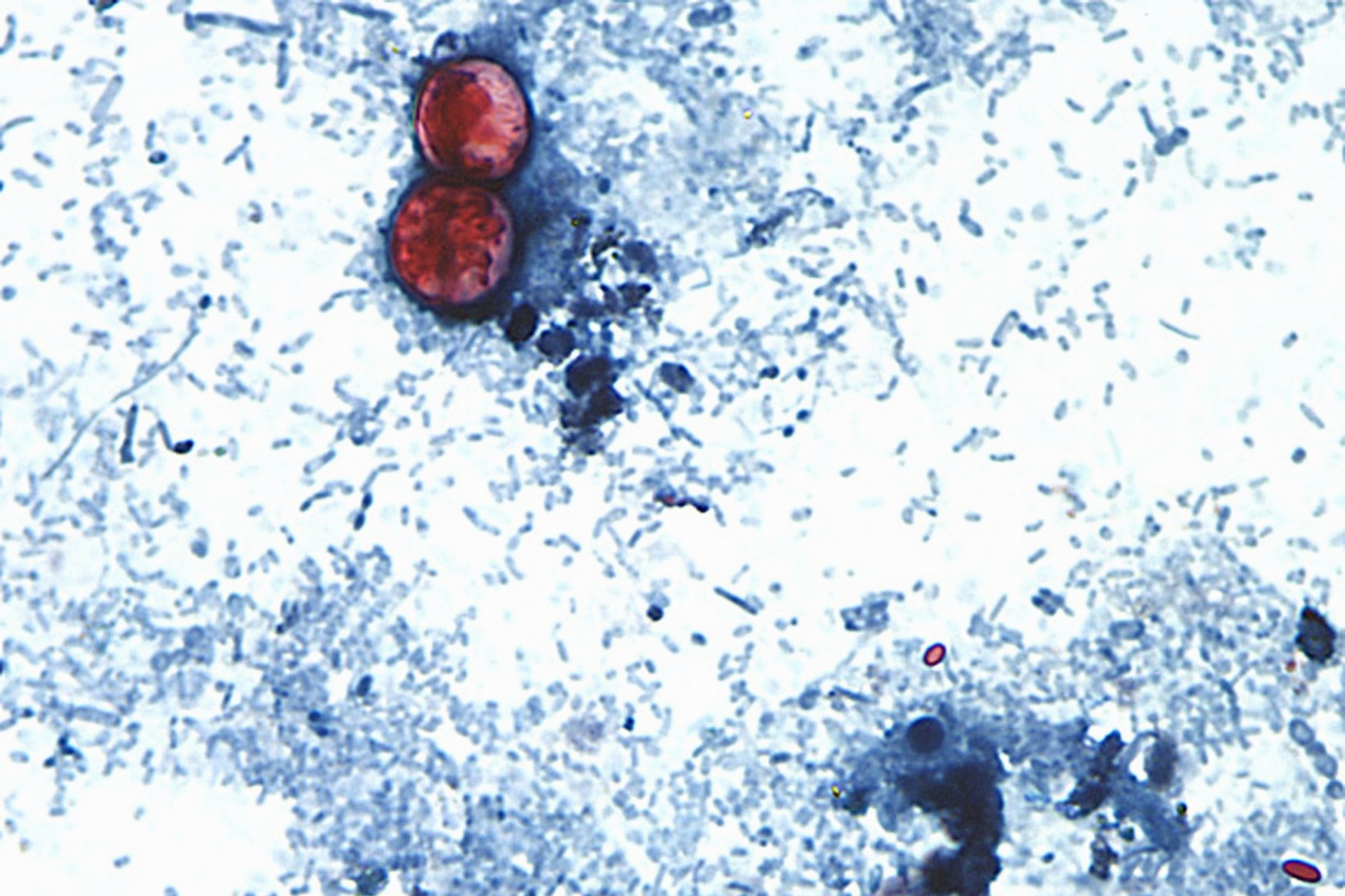 MÉXICO-CYCLOSPORA