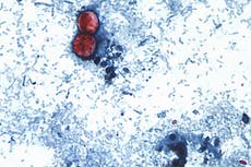 México confirma 33 casos de cyclospora y activa vigilancia epidemiológica