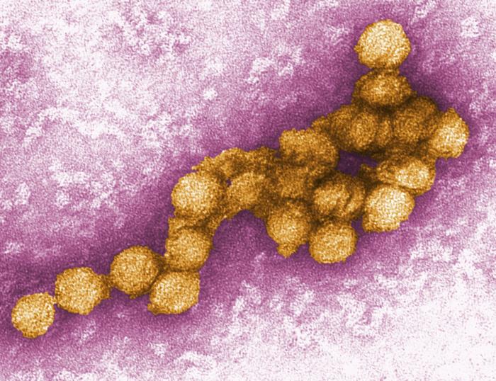 El virus del Nilo Occidental visto bajo un microscopio. Las infecciones graves pueden provocar parálisis e inflamación del cerebro y la médula espinal