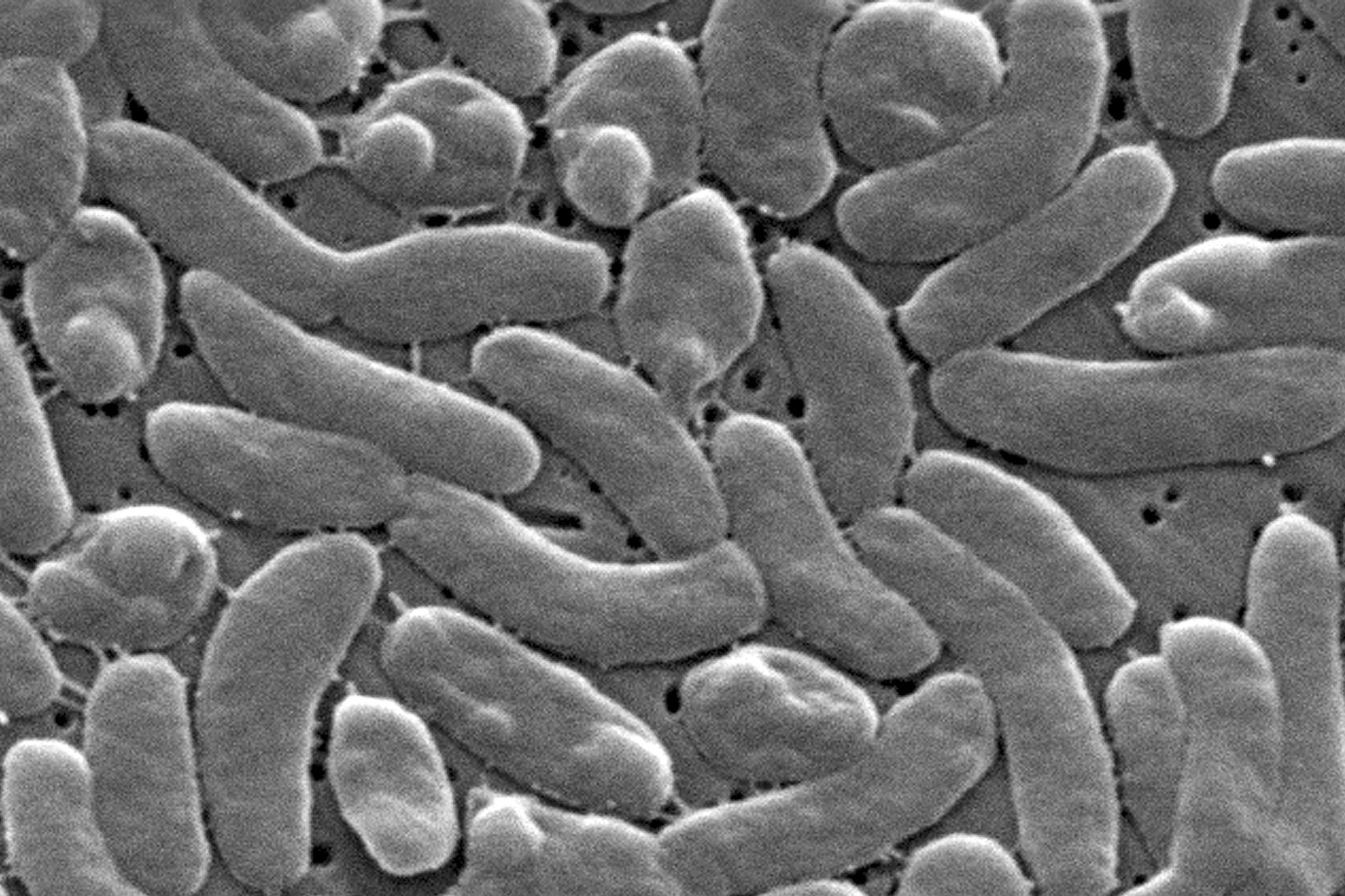 EEUU-BACTERIA CARNÍVORA