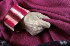 Científicos podrían haber descubierto una causa clave del Alzheimer