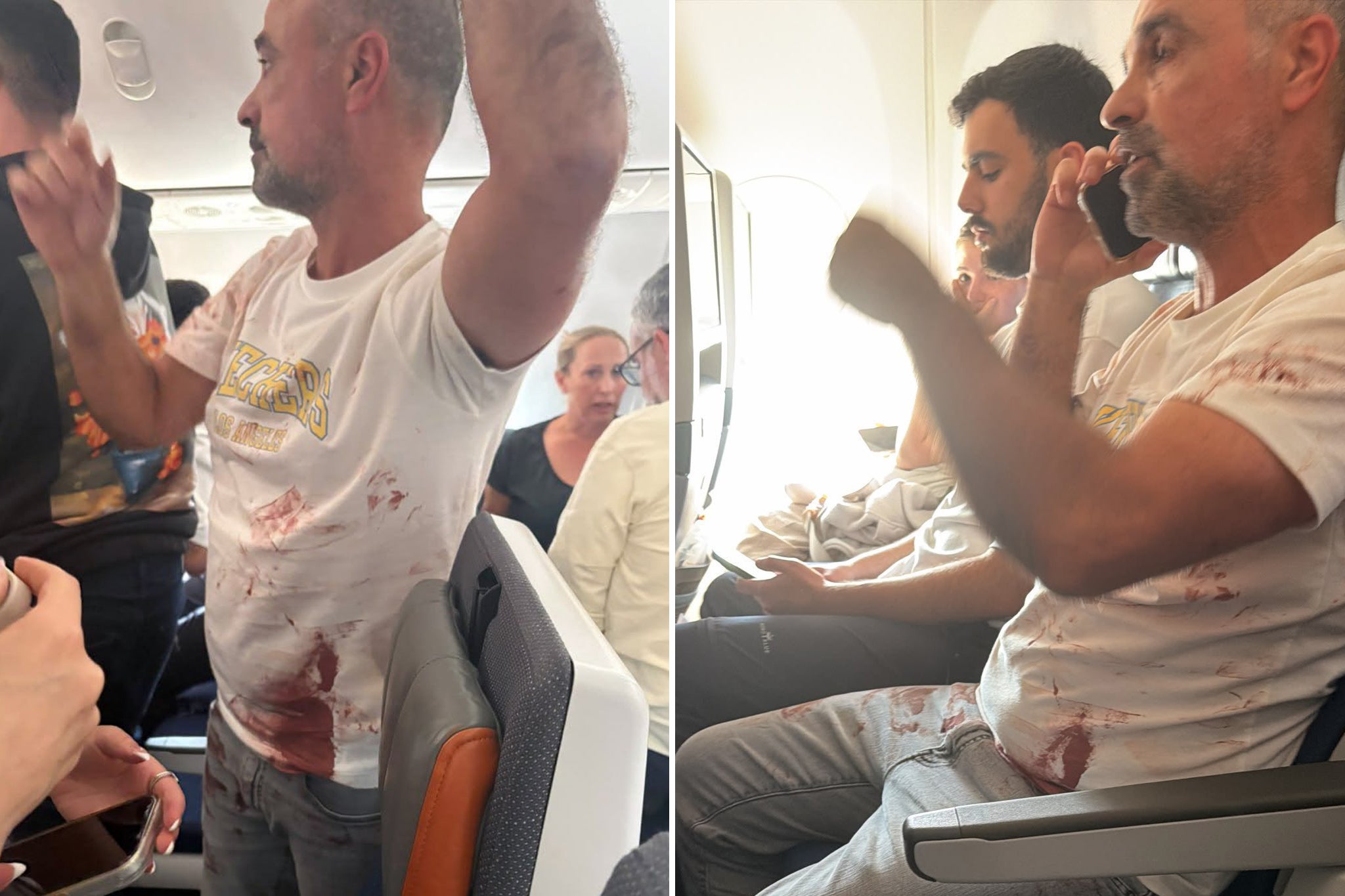 Imágenes difundidas por medios israelíes muestran a un pasajero de un vuelo de flydubai cubierto de sangre tras presuntamente ayudar a frustrar el secuestro del avión