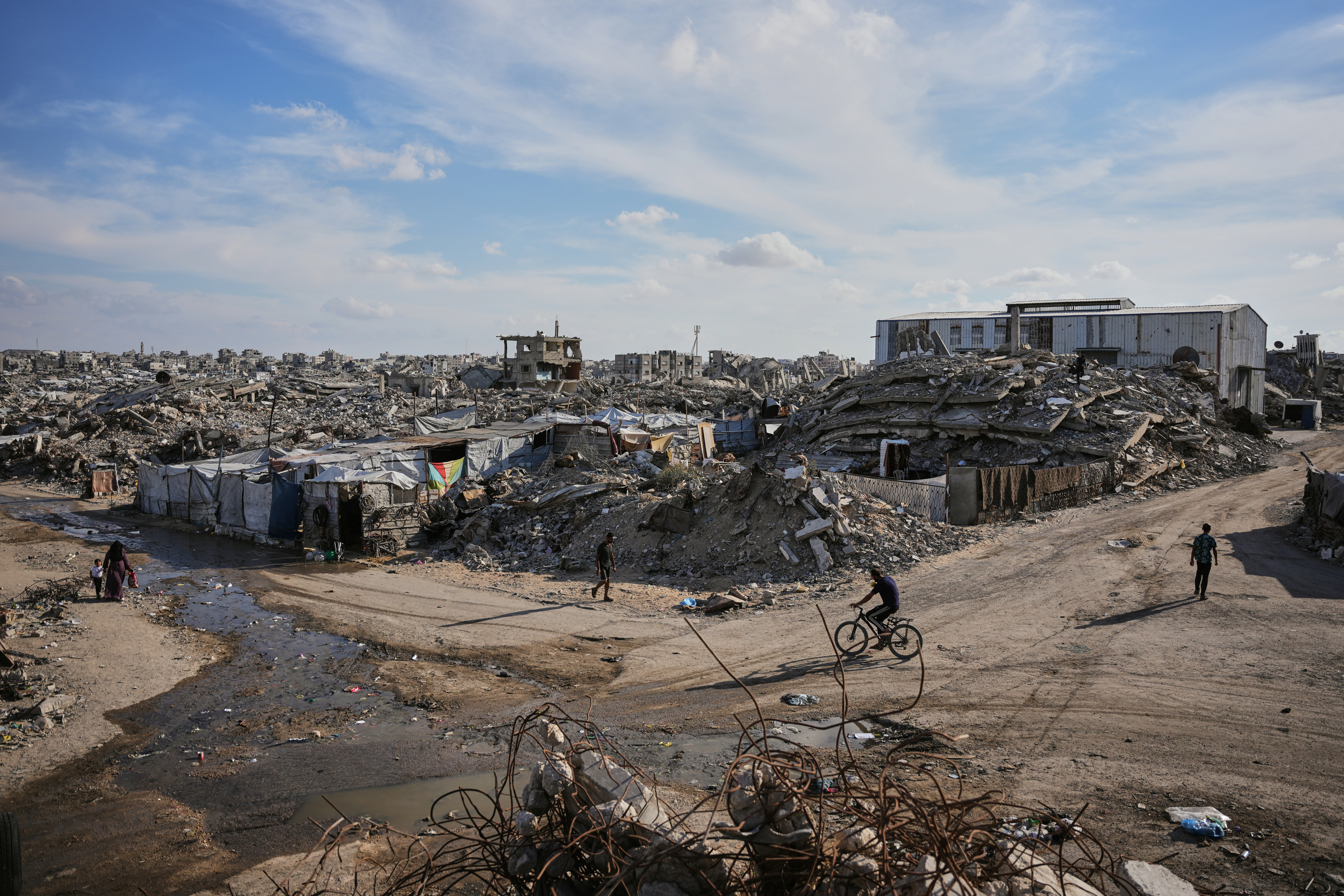 ISRAEL-PALESTINOS-HERIDAS DE GAZA
