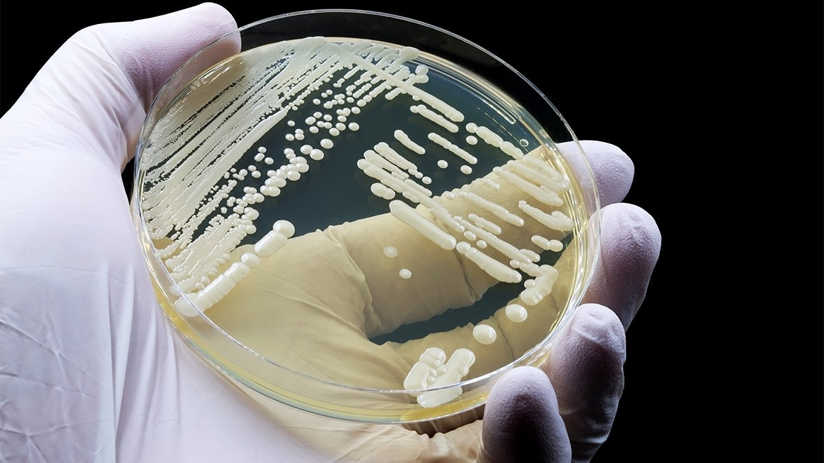 Según un nuevo informe de los CDC, hay cuatro patógenos peligrosos, entre ellos la Candida auris (en la imagen), que se están propagando por todo el país y que son cada vez más resistentes a los medicamentos con los que se combaten
